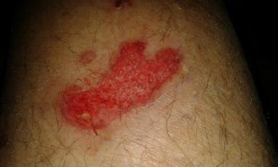 post-6671-0-17412500-1440538986_thumb.jp